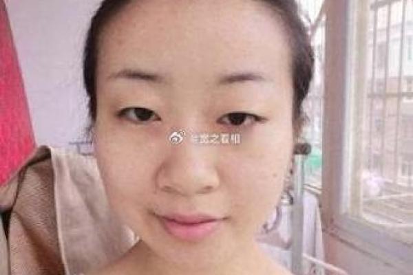 颧骨出现八字纹面相_颧骨显现八字皱纹面相特征