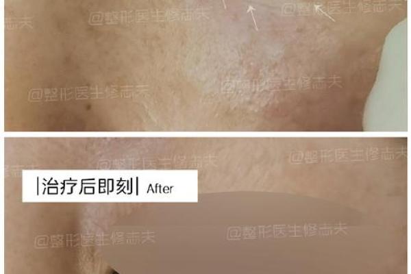探究女性面相中的阴骘纹特征及其深层含义