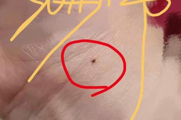 女性左手腕痣解析：揭秘手腕痣的含义与女性关联
